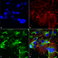 Mouse Anti-GluA1 Antibody [N355/1] used in Immunocytochemistry/Immunofluorescence (ICC/IF) on Human Neuroblastoma cells (SH-SY5Y) (SMC-440)