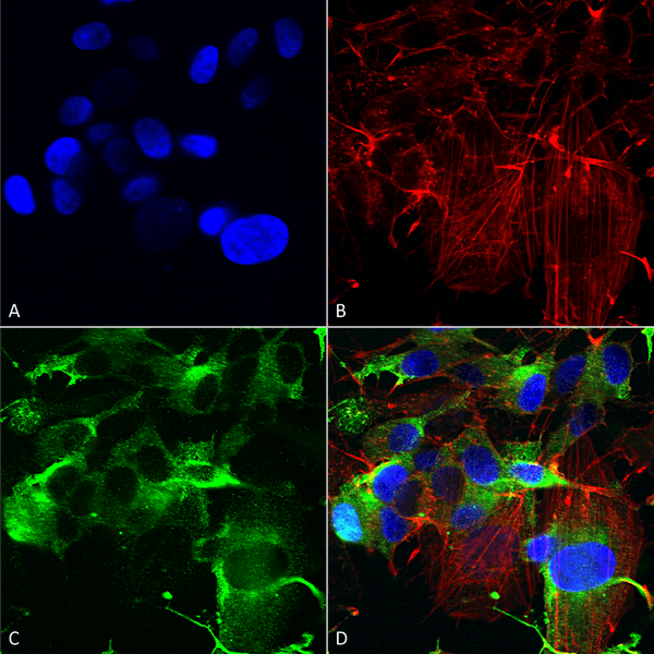Mouse Anti-GluA1 Antibody [N355/1] used in Immunocytochemistry/Immunofluorescence (ICC/IF) on Human Neuroblastoma cells (SH-SY5Y) (SMC-440)