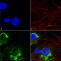 Mouse Anti-GFAP R416WT Antibody [N206B/9] used in Immunocytochemistry/Immunofluorescence (ICC/IF) on Human Neuroblastoma cells (SH-SY5Y) (SMC-442)
