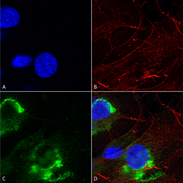 Mouse Anti-GFAP R416WT Antibody [N206B/9] used in Immunocytochemistry/Immunofluorescence (ICC/IF) on Human Neuroblastoma cells (SH-SY5Y) (SMC-442)