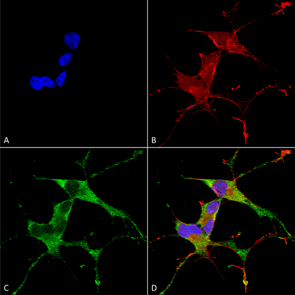 Mouse Anti-LRRK2/Dardarin Antibody [N231B/34] used in Immunocytochemistry/Immunofluorescence (ICC/IF) on Human Neuroblastoma cells (SH-SY5Y) (SMC-445)