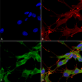Mouse Anti-LRRK2/Dardarin Antibody [N138/6] used in Immunocytochemistry/Immunofluorescence (ICC/IF) on Human Neuroblastoma cells (SH-SY5Y) (SMC-446)