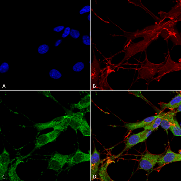 Mouse Anti-LRRK2/Dardarin Antibody [N138/6] used in Immunocytochemistry/Immunofluorescence (ICC/IF) on Human Neuroblastoma cells (SH-SY5Y) (SMC-446)