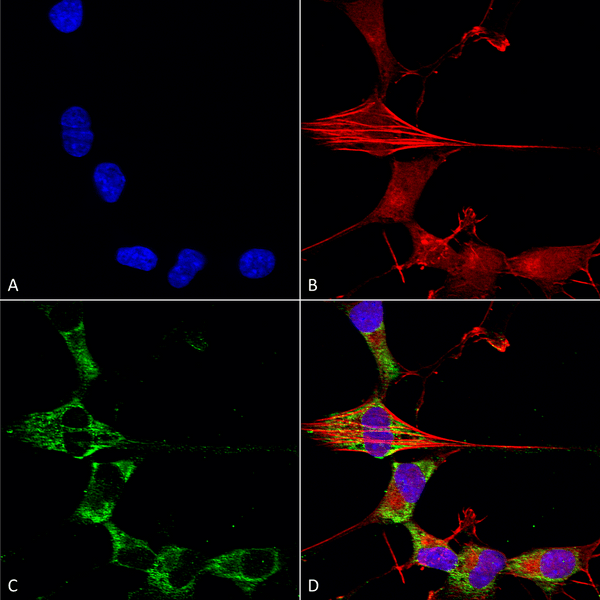 Mouse Anti-FHF2A (FGF13) Antibody [N235/22] used in Immunocytochemistry/Immunofluorescence (ICC/IF) on Human Neuroblastoma cells (SH-SY5Y) (SMC-448)