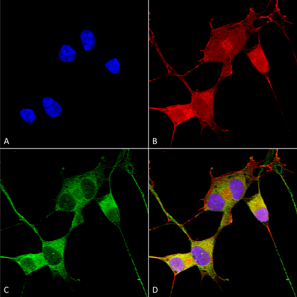 Mouse Anti-Ataxin 1 Antibody [N76/8] used in Immunocytochemistry/Immunofluorescence (ICC/IF) on Human Neuroblastoma cells (SH-SY5Y) (SMC-455)