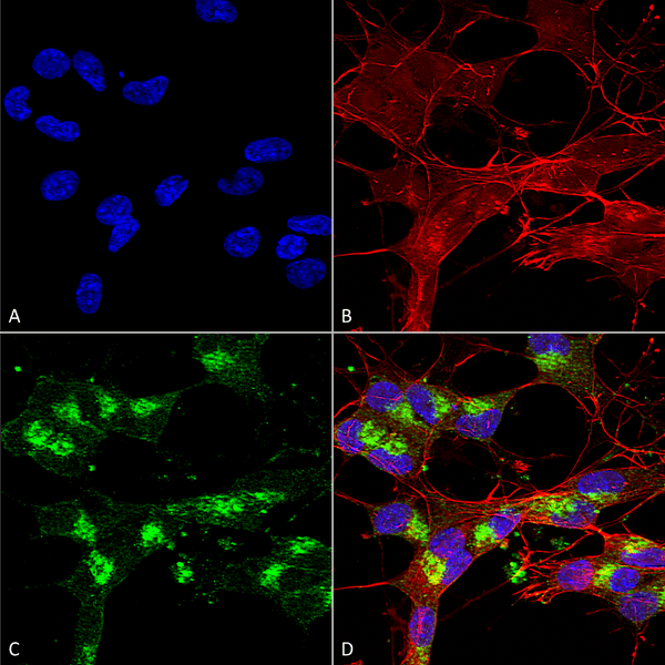 Mouse Anti-VDAC1 Antibody [N152B/23] used in Immunocytochemistry/Immunofluorescence (ICC/IF) on Human Neuroblastoma cells (SH-SY5Y) (SMC-456)