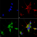 Mouse Anti-SHANK1/SHANK3 Antibody [N367/51] used in Immunocytochemistry/Immunofluorescence (ICC/IF) on Human Neuroblastoma cells (SH-SY5Y) (SMC-460)