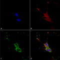 Mouse Anti-LGI1 Antibody [N283/7] used in Immunocytochemistry/Immunofluorescence (ICC/IF) on Human Neuroblastoma cells (SH-SY5Y) (SMC-461)