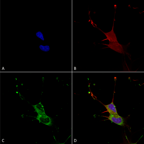 Mouse Anti-LGI1 Antibody [N283/7] used in Immunocytochemistry/Immunofluorescence (ICC/IF) on Human Neuroblastoma cells (SH-SY5Y) (SMC-461)