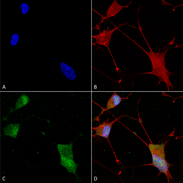 Mouse Anti-Neuroligin 1 Antibody [N97A/31] used in Immunocytochemistry/Immunofluorescence (ICC/IF) on Human Neuroblastoma cells (SH-SY5Y) (SMC-463)