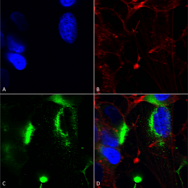 Mouse Anti-QKI (pan) Antibody [N147/6] used in Immunocytochemistry/Immunofluorescence (ICC/IF) on Human Neuroblastoma cells (SH-SY5Y) (SMC-467)