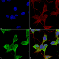 Mouse Anti-TASK1 Potassium Channel Antibody [N374/48] used in Immunocytochemistry/Immunofluorescence (ICC/IF) on Human Neuroblastoma cells (SH-SY5Y) (SMC-473)