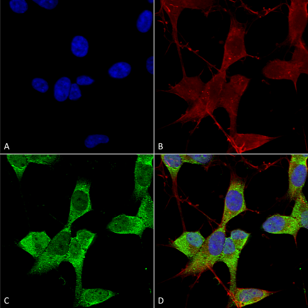 Mouse Anti-TASK1 Potassium Channel Antibody [N374/48] used in Immunocytochemistry/Immunofluorescence (ICC/IF) on Human Neuroblastoma cells (SH-SY5Y) (SMC-473)