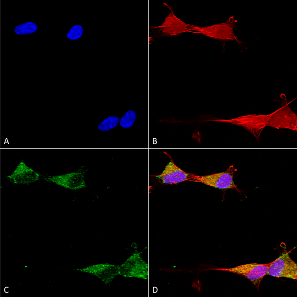 Mouse Anti-Ataxin 1 Antibody [N65/37] used in Immunocytochemistry/Immunofluorescence (ICC/IF) on Human Neuroblastoma cells (SH-SY5Y) (SMC-475)