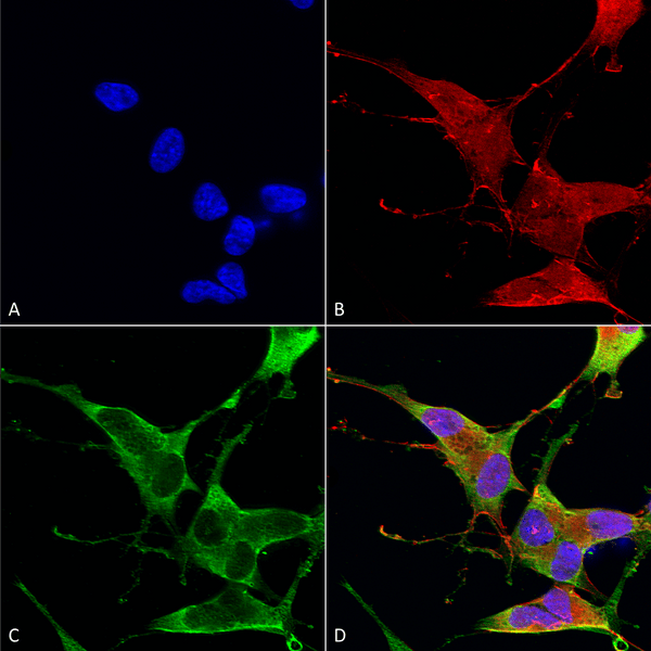 Mouse Anti-Ankyrin R Antibody [N388A/10] used in Immunocytochemistry/Immunofluorescence (ICC/IF) on Human Neuroblastoma cells (SH-SY5Y) (SMC-487)