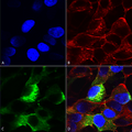 Mouse Anti-Nav beta3 Antibody [N396/29] used in Immunocytochemistry/Immunofluorescence (ICC/IF) on Human Neuroblastoma cells (SH-SY5Y) (SMC-490)