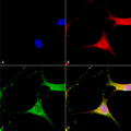 Mouse Anti-Kir6.1 Antibody [N366/60] used in Immunocytochemistry/Immunofluorescence (ICC/IF) on Human Neuroblastoma cells (SH-SY5Y) (SMC-491)