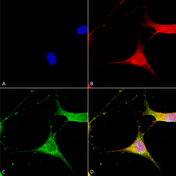 Mouse Anti-Kir6.1 Antibody [N366/60] used in Immunocytochemistry/Immunofluorescence (ICC/IF) on Human Neuroblastoma cells (SH-SY5Y) (SMC-491)