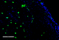 Mouse Anti-Acrolein Antibody [10A10] used in Immunohistochemistry (IHC) on Human Adrenal Carcinoma (SMC-505)
