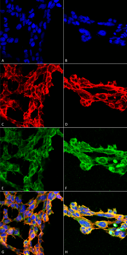 Mouse Anti-7-Ketocholesterol Antibody [7E1] used in Immunocytochemistry/Immunofluorescence (ICC/IF) on  Embryonic kidney epithelial cell line (HEK293) (SMC-512)