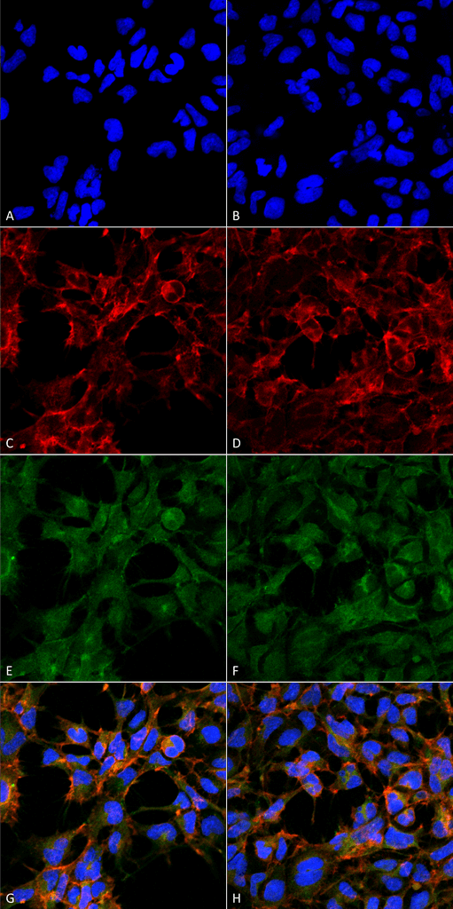 Mouse Anti-Malondialdehyde Antibody [6H6] used in Immunocytochemistry/Immunofluorescence (ICC/IF) on  Embryonic kidney epithelial cell line (HEK293) (SMC-514)