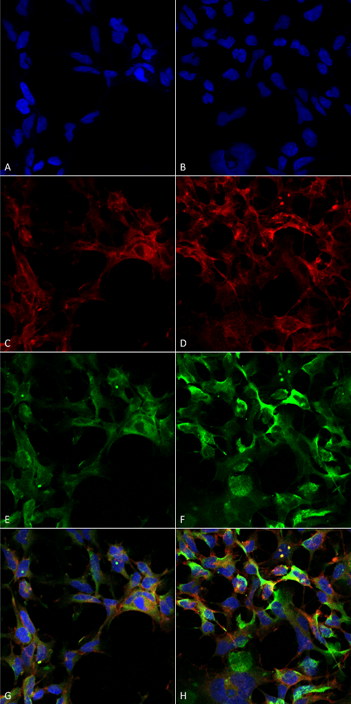 Mouse Anti-Dityrosine Antibody [10A6] used in Immunocytochemistry/Immunofluorescence (ICC/IF) on Human Embryonic kidney epithelial cell line (HEK293) (SMC-521)