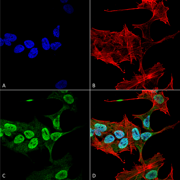 Mouse Anti-Alpha Synuclein Antibody [3C11] used in Immunocytochemistry/Immunofluorescence (ICC/IF) on Human Neuroblastoma cell line (SK-N-BE) (SMC-530)