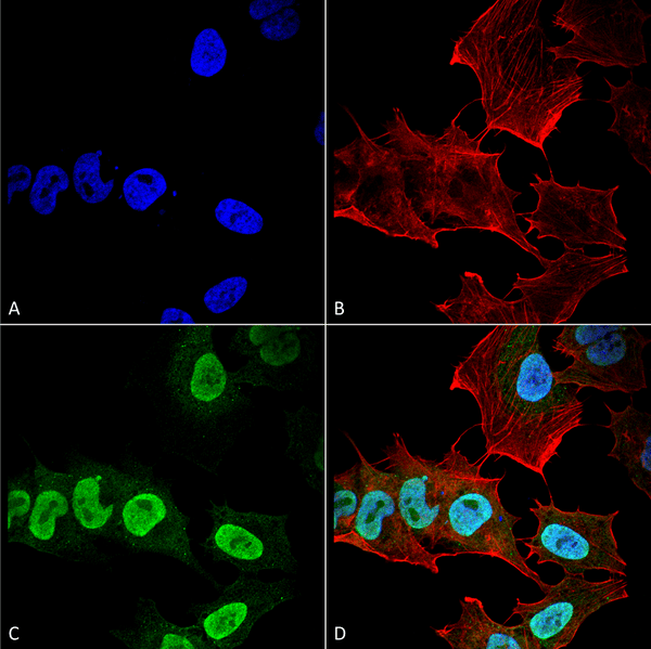 Mouse Anti-Alpha Synuclein Antibody [10H7] used in Immunocytochemistry/Immunofluorescence (ICC/IF) on Human Neuroblastoma cell line (SK-N-BE) (SMC-531)