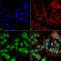 Mouse Anti-Alpha Synuclein Antibody [3F8] used in Immunocytochemistry/Immunofluorescence (ICC/IF) on Human Neuroblastoma cell line (SK-N-BE) (SMC-532)