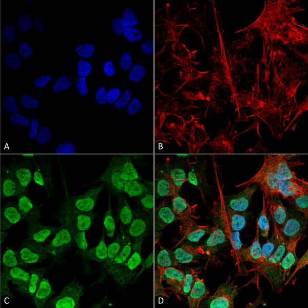 Mouse Anti-Alpha Synuclein Antibody [3F8] used in Immunocytochemistry/Immunofluorescence (ICC/IF) on Human Neuroblastoma cell line (SK-N-BE) (SMC-532)