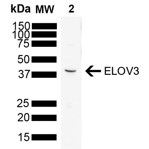 Mouse Anti-ELOVL3 Antibody [V61P2B3-D10] used in Western Blot (WB) on Rat brain (SMC-555)