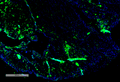 Mouse Anti-Parvalbumin Antibody [C12] used in Immunohistochemistry (IHC) on Human Thyroid Cancer (SMC-563)