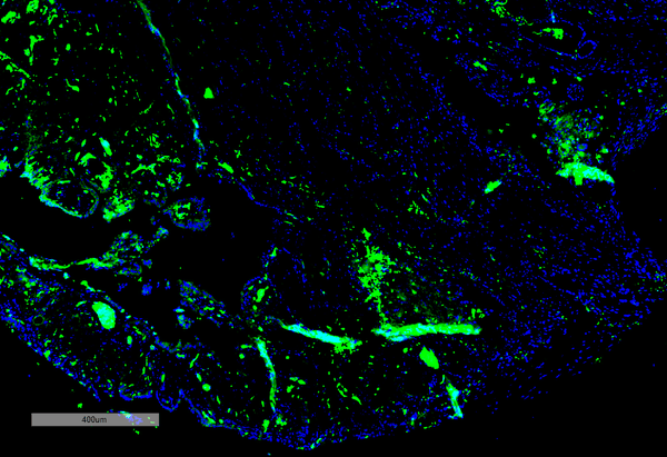Mouse Anti-Parvalbumin Antibody [C12] used in Immunohistochemistry (IHC) on Human Thyroid Cancer (SMC-563)