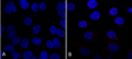 Mouse Anti-VPS35 Antibody [7E4] used in Immunocytochemistry/Immunofluorescence (ICC/IF) on Human A549 cells (SMC-602)