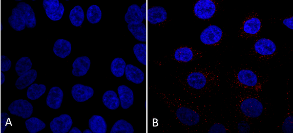 Mouse Anti-VPS35 Antibody [7E4] used in Immunocytochemistry/Immunofluorescence (ICC/IF) on Human A549 cells (SMC-602)