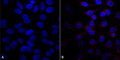Mouse Anti-VPS35 Antibody [5A9] used in Immunocytochemistry/Immunofluorescence (ICC/IF) on Human A549 cells (SMC-603)