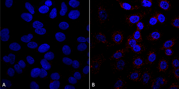 Mouse Anti-VPS35 Antibody [5A9] used in Immunocytochemistry/Immunofluorescence (ICC/IF) on Human A549 cells (SMC-603)