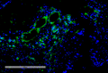 Mouse Anti-VPS35 Antibody [11H10] used in Immunohistochemistry (IHC) on Human Intestinal Cancer (SMC-606)