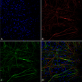 Mouse Anti-Tau Antibody [1D5] used in Immunocytochemistry/Immunofluorescence (ICC/IF) on Human iPSC-derived neurons (SMC-607)