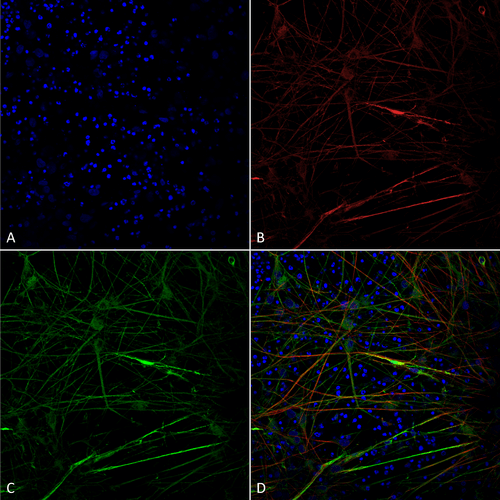 Mouse Anti-Tau Antibody [1D5] used in Immunocytochemistry/Immunofluorescence (ICC/IF) on Human iPSC-derived neurons (SMC-607)