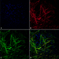 Mouse Anti-Tau Antibody [3D4] used in Immunocytochemistry/Immunofluorescence (ICC/IF) on Human iPSC-derived neurons (SMC-608)