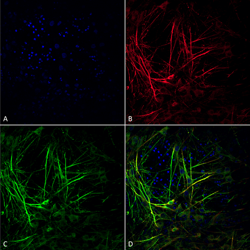 Mouse Anti-Tau Antibody [3D4] used in Immunocytochemistry/Immunofluorescence (ICC/IF) on Human iPSC-derived neurons (SMC-608)