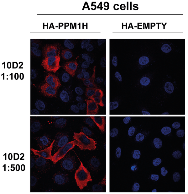 Mouse Anti-PPM1H Antibody [10D2] used in Immunocytochemistry/Immunofluorescence (ICC/IF) on Hu, Ms, Rt Alveolar Basal Epithelial cells (A549) (SMC-616)