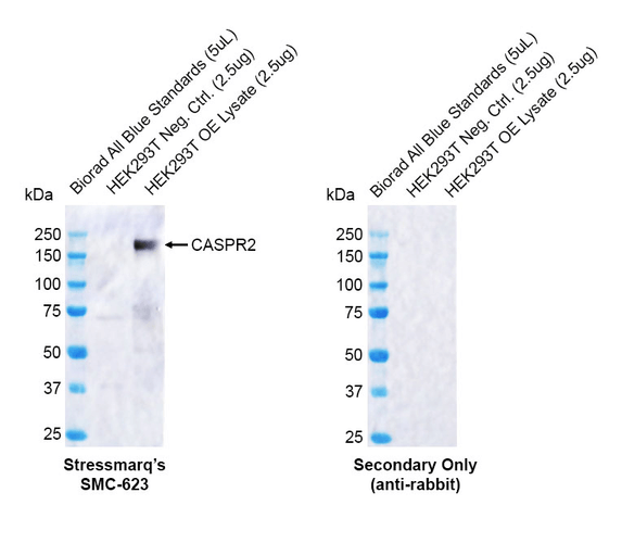 Rabbit Anti-CASPR2 Antibody [FF19] used in Western Blot (WB) on  HumanOE lysate (SMC-623)