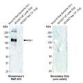 Rabbit Anti-Slo1 Antibody [S22] used in Western Blot (WB) on Human OE lysate  (SMC-625)