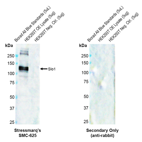 Rabbit Anti-Slo1 Antibody [S22] used in Western Blot (WB) on Human OE lysate  (SMC-625)