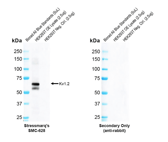 Rabbit Anti-Kv1.2 Antibody [C25] used in Western Blot (WB) on Human OE lysate (SMC-628)