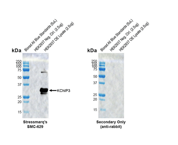 Rabbit Anti-KChIP3 Antibody [X12] used in Western Blot (WB) on Human Transient OE lysate (SMC-629)