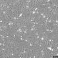 SNU-387 cell