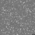 SNU-449 cell